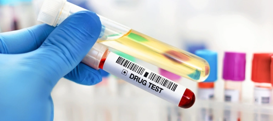 Drug Testing Requirements for Local and State Employees