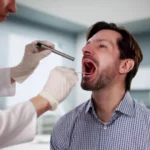 Image of a man receiving a saliva test from a technician - How Long Does Alcohol Stay in Saliva - Icarus Wellness and Recovery