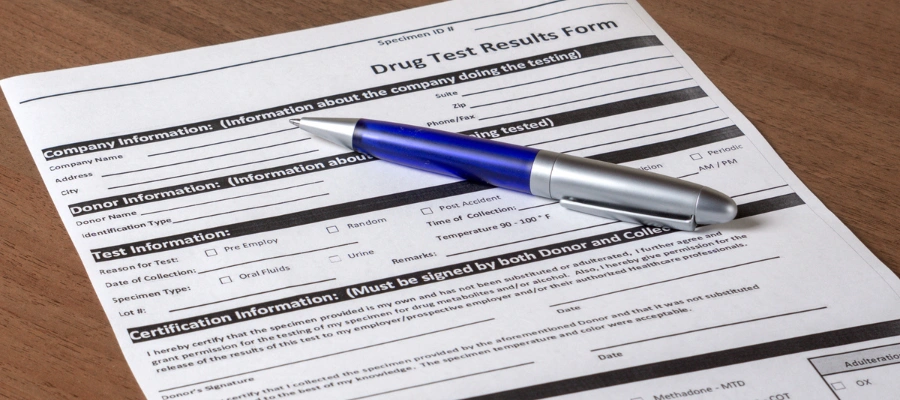 Probation drug test results indicating illegal substance use and potential legal consequences